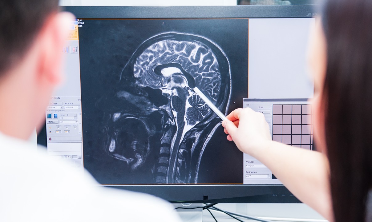 Ερευνητές Πανεπιστημίου κατέγραψαν τι συμβαίνει στον εγκέφαλο όταν πεθαίνουμε - Τα ευρήματα που εντυπωσιάζουν